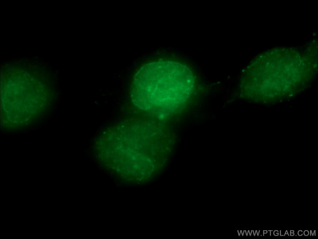 PARP1 Antibody in Immunocytochemistry (ICC/IF)