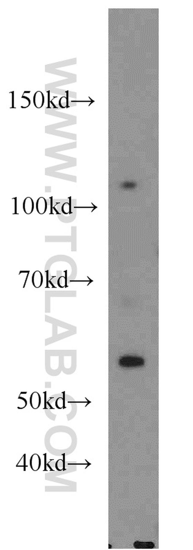 PARP1 Antibody in Western Blot (WB)