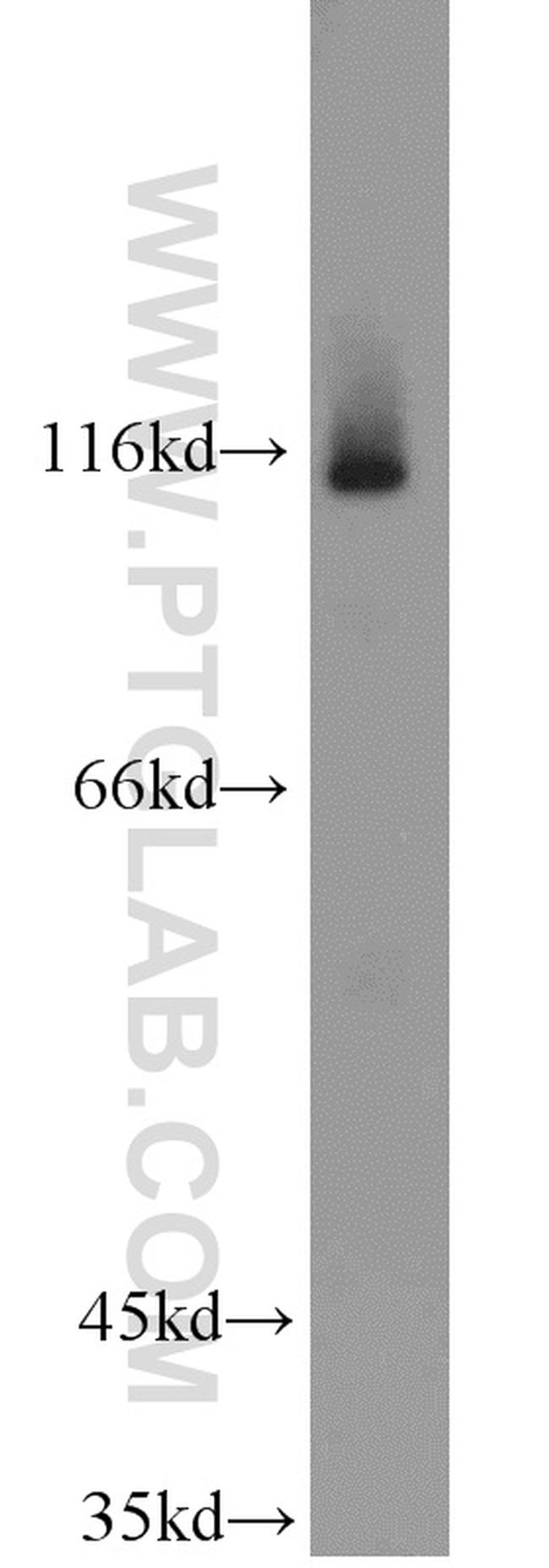 PARP1 Antibody in Western Blot (WB)