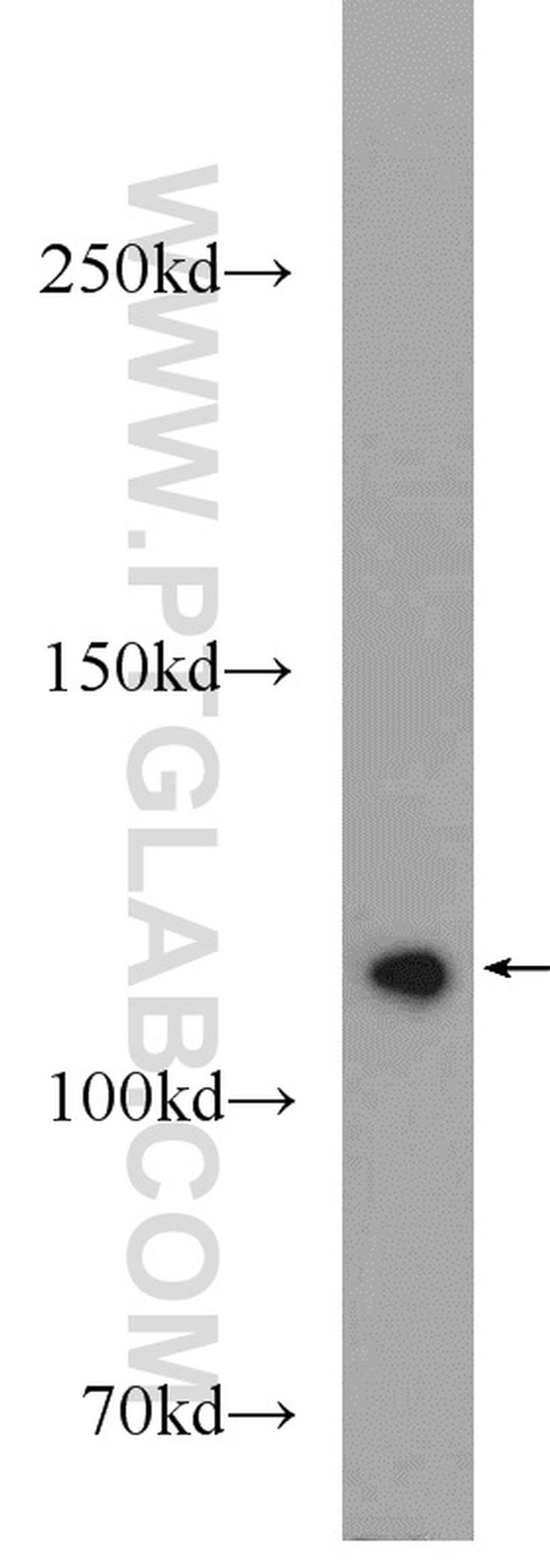 PARP1 Antibody in Western Blot (WB)