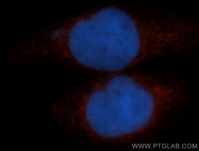 TFEB Antibody in Immunocytochemistry (ICC/IF)