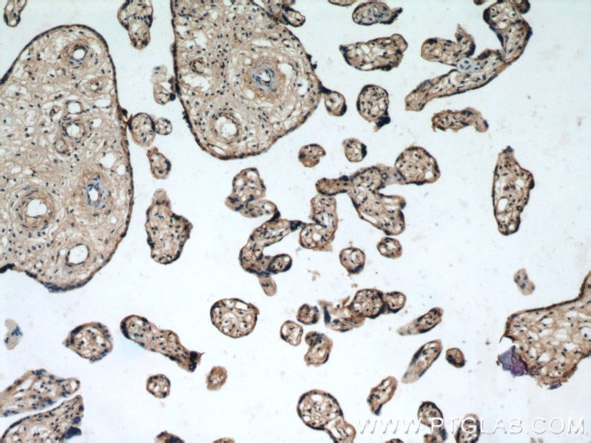 TFEB Antibody in Immunohistochemistry (Paraffin) (IHC (P))