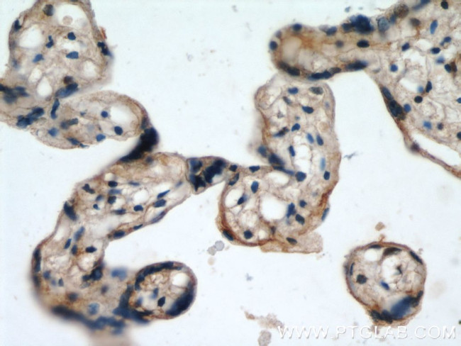 TFEB Antibody in Immunohistochemistry (Paraffin) (IHC (P))