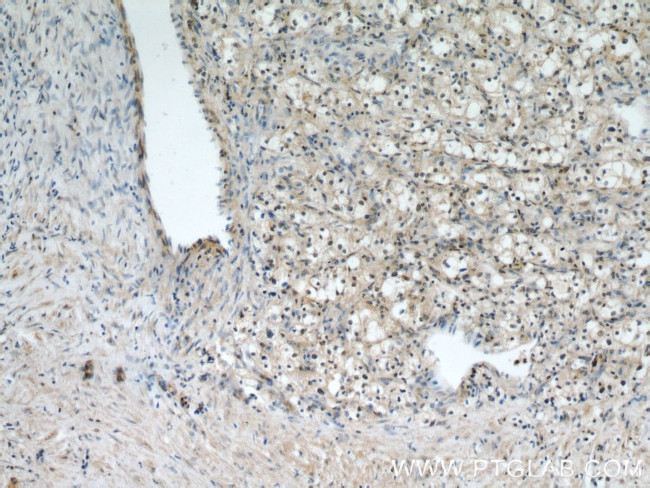 TFEB Antibody in Immunohistochemistry (Paraffin) (IHC (P))