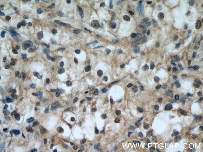 TFEB Antibody in Immunohistochemistry (Paraffin) (IHC (P))