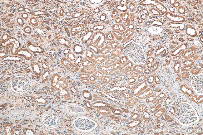 TFEB Antibody in Immunohistochemistry (Paraffin) (IHC (P))