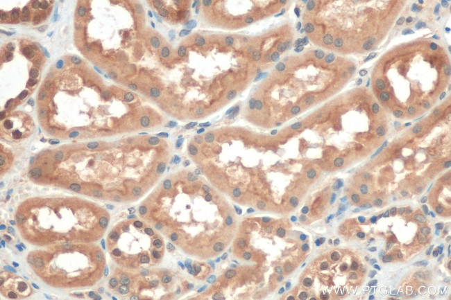 TFEB Antibody in Immunohistochemistry (Paraffin) (IHC (P))