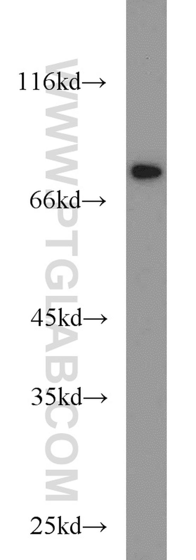 TFEB Antibody in Western Blot (WB)