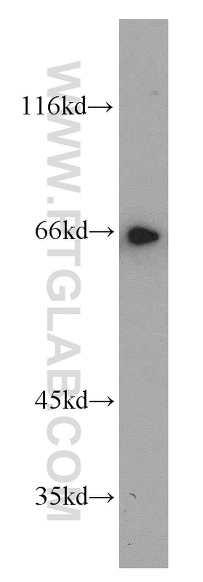 TFEB Antibody in Western Blot (WB)