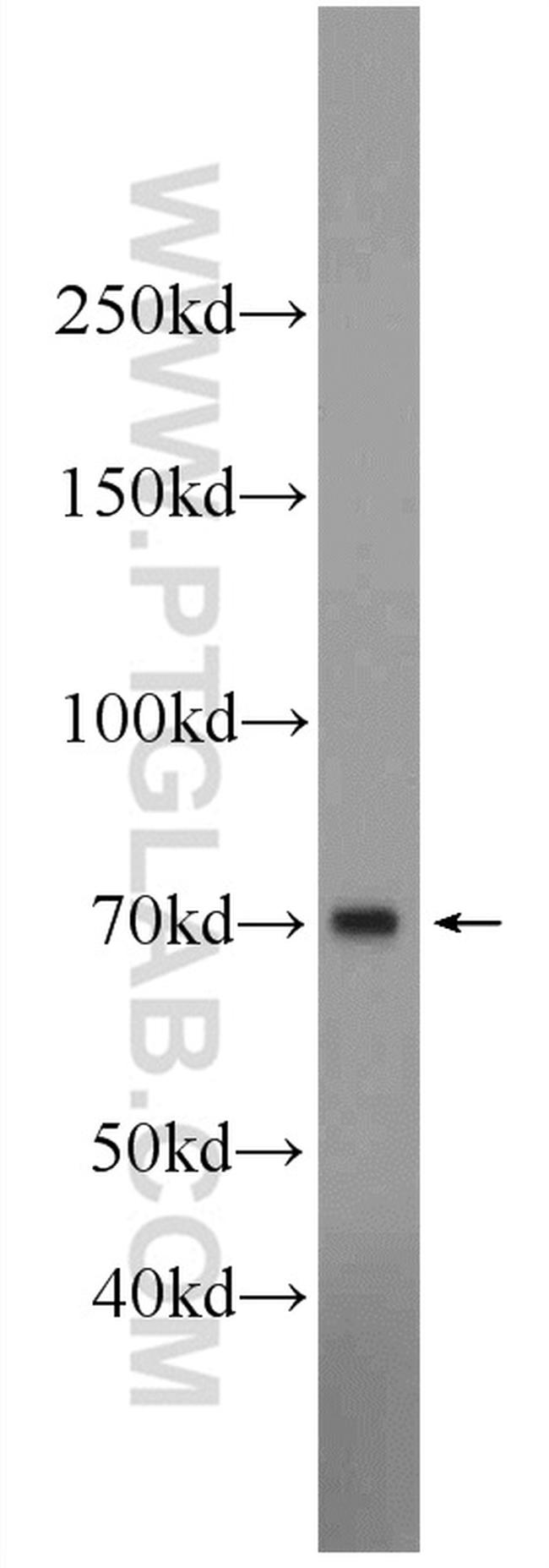 TFEB Antibody in Western Blot (WB)