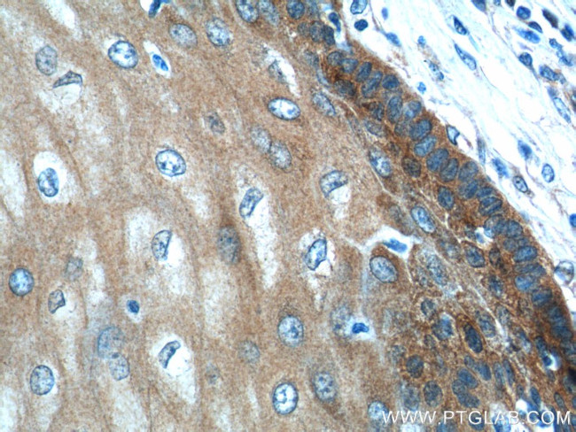 LYNX1 Antibody in Immunohistochemistry (Paraffin) (IHC (P))