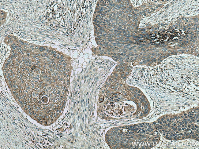 LYNX1 Antibody in Immunohistochemistry (Paraffin) (IHC (P))