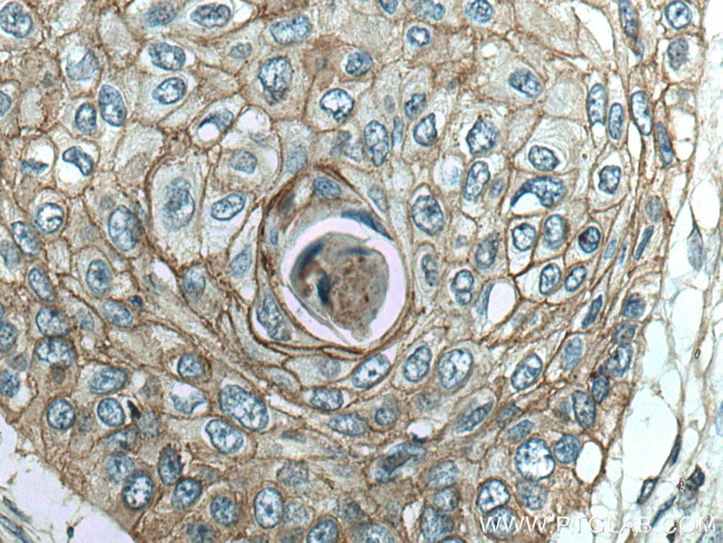 LYNX1 Antibody in Immunohistochemistry (Paraffin) (IHC (P))