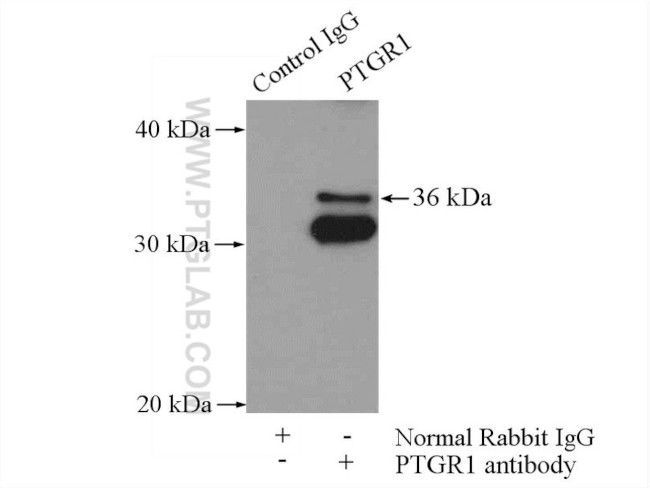 PTGR1 Antibody in Immunoprecipitation (IP)