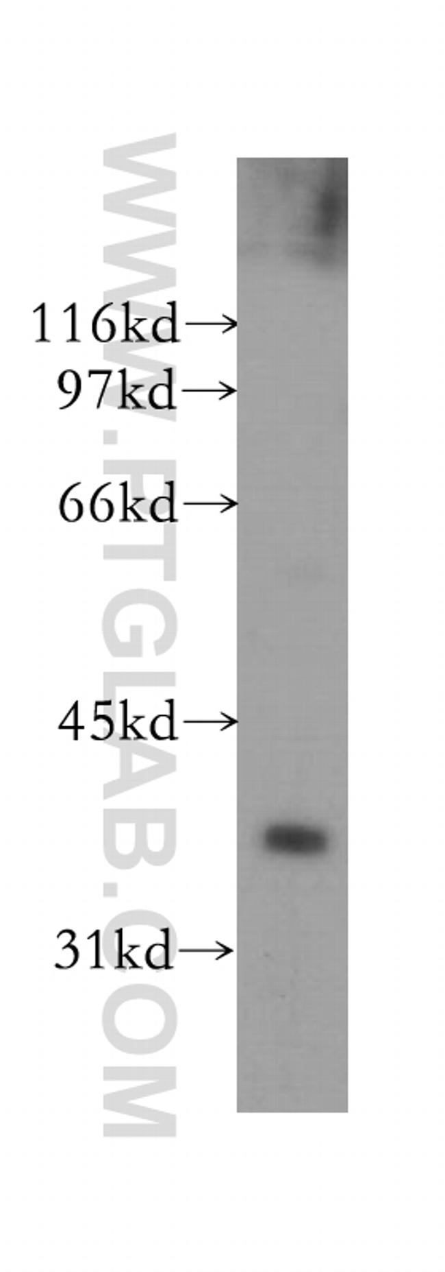 PTGR1 Antibody in Western Blot (WB)