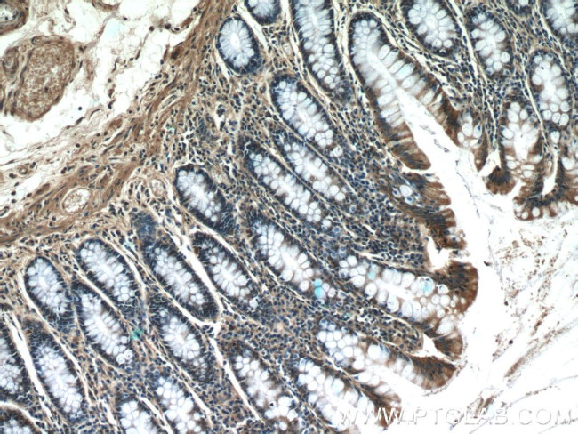 SCFD2 Antibody in Immunohistochemistry (Paraffin) (IHC (P))