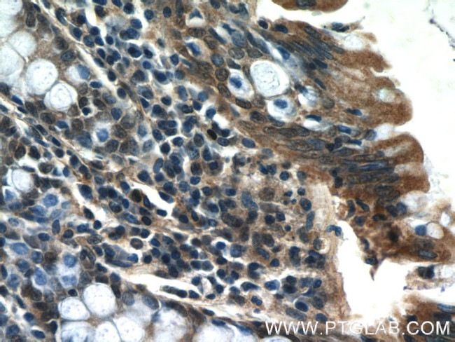 SCFD2 Antibody in Immunohistochemistry (Paraffin) (IHC (P))