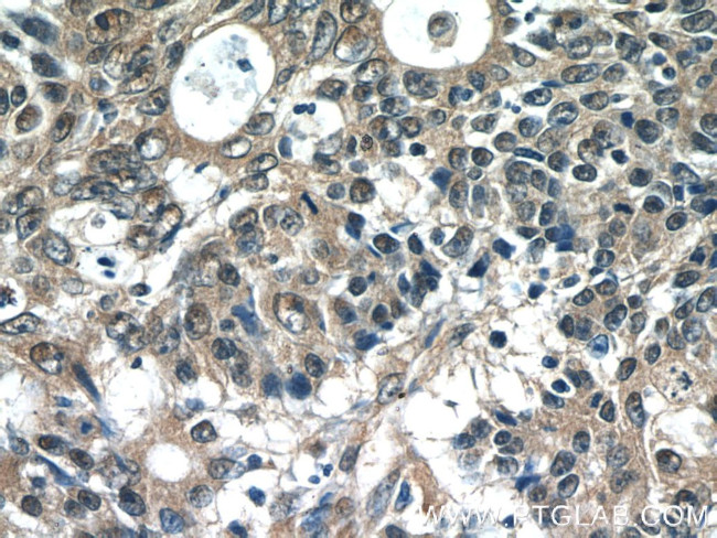 SCFD2 Antibody in Immunohistochemistry (Paraffin) (IHC (P))