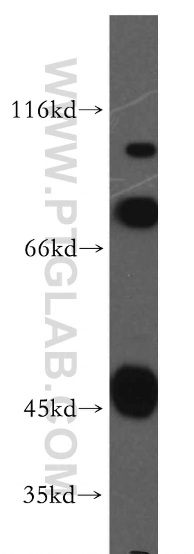 SCFD2 Antibody in Western Blot (WB)