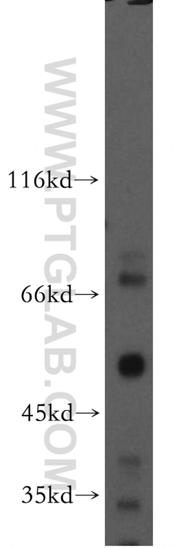 SCFD2 Antibody in Western Blot (WB)