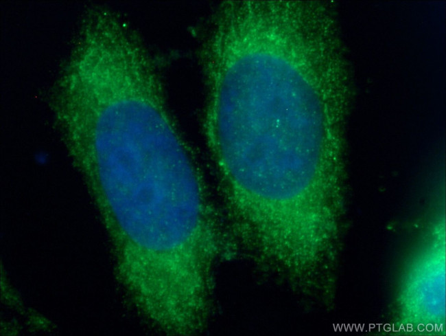 CDC20B Antibody in Immunocytochemistry (ICC/IF)