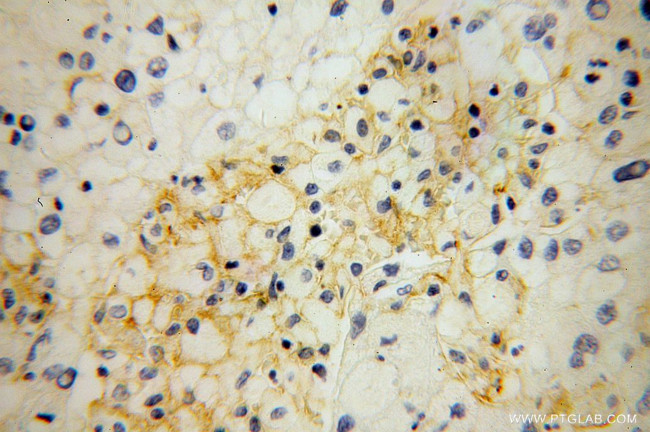 SIGLEC9 Antibody in Immunohistochemistry (Paraffin) (IHC (P))