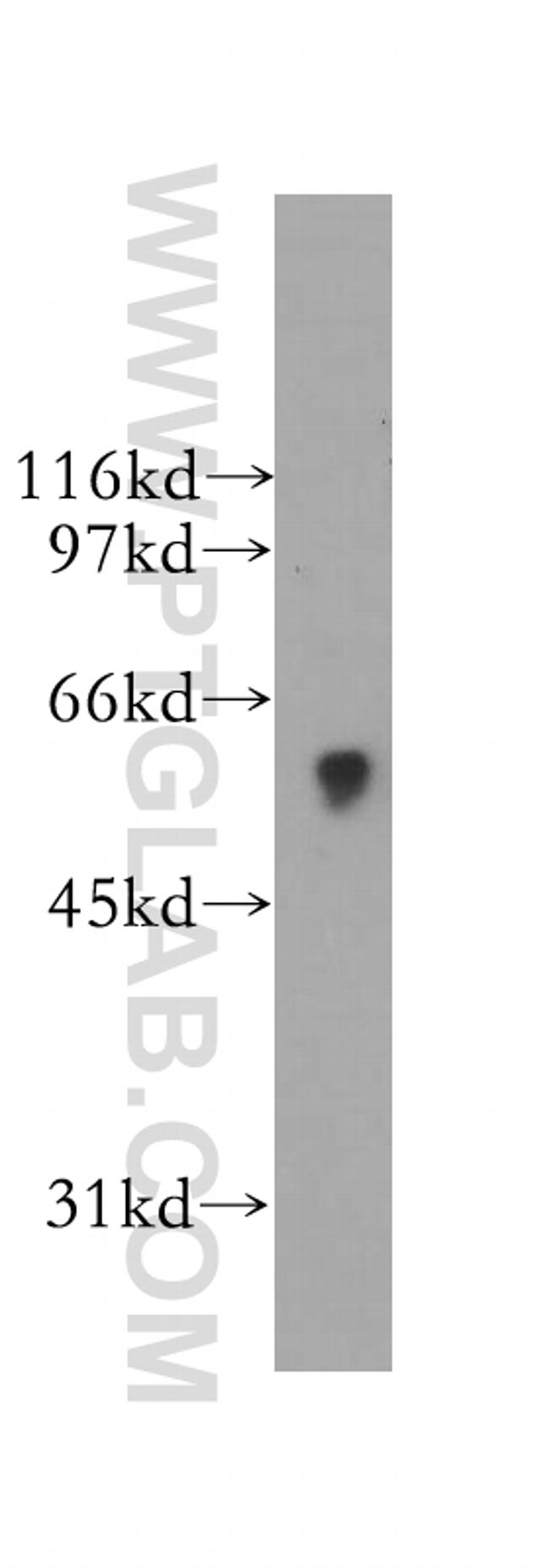 SIGLEC9 Antibody in Western Blot (WB)