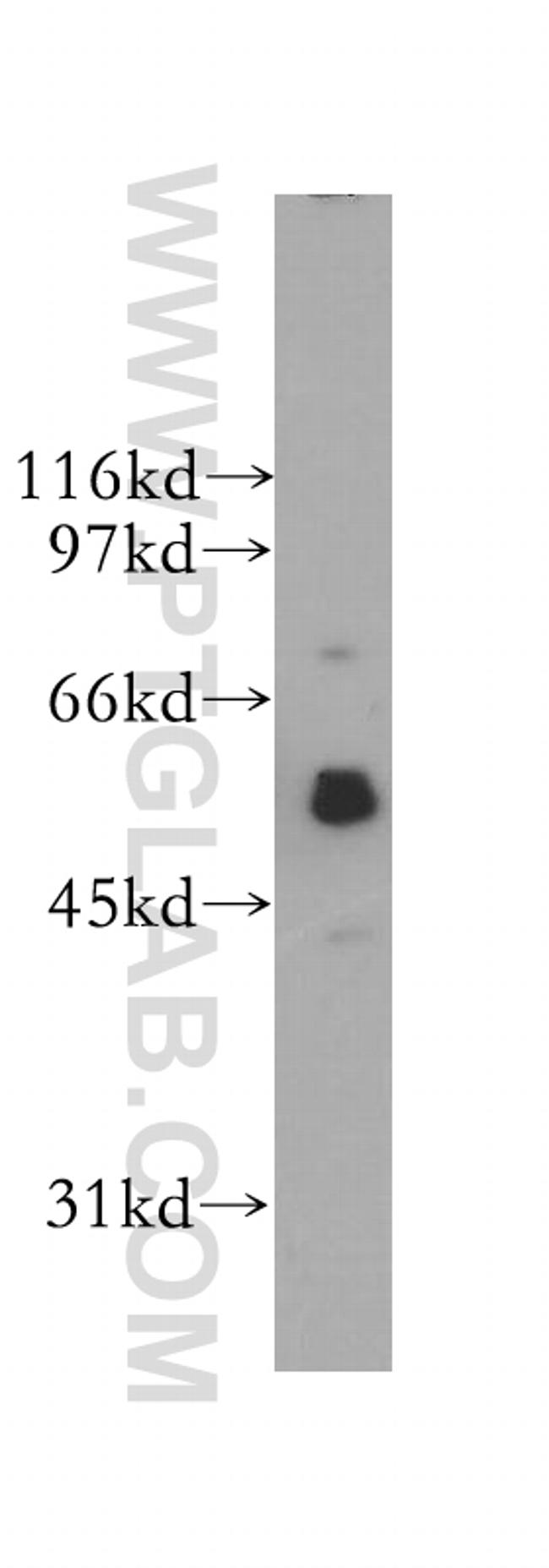 SIGLEC9 Antibody in Western Blot (WB)