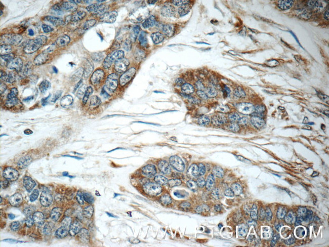 IFIT5 Antibody in Immunohistochemistry (Paraffin) (IHC (P))