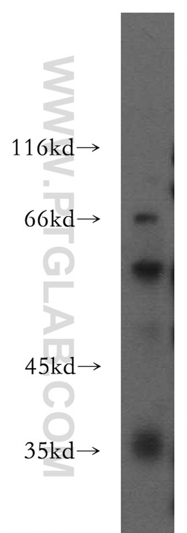 IFIT5 Antibody in Western Blot (WB)