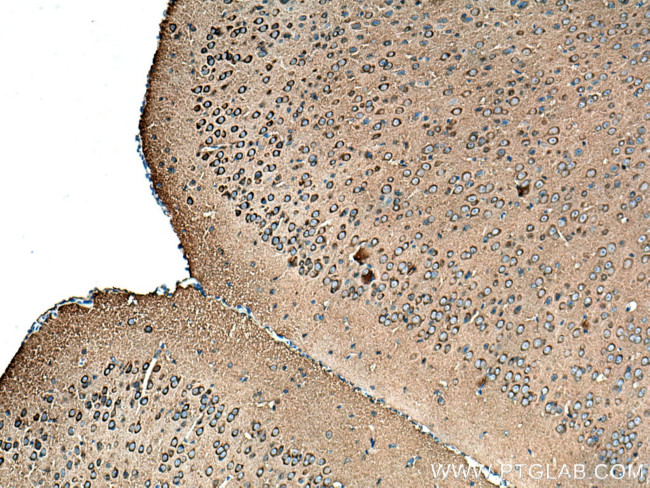 Amphiphysin Antibody in Immunohistochemistry (Paraffin) (IHC (P))