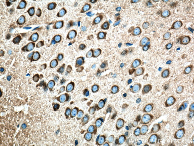 Amphiphysin Antibody in Immunohistochemistry (Paraffin) (IHC (P))