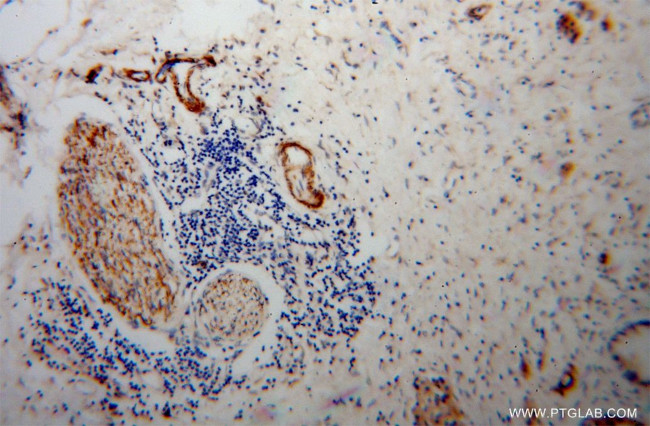 Amphiphysin Antibody in Immunohistochemistry (Paraffin) (IHC (P))