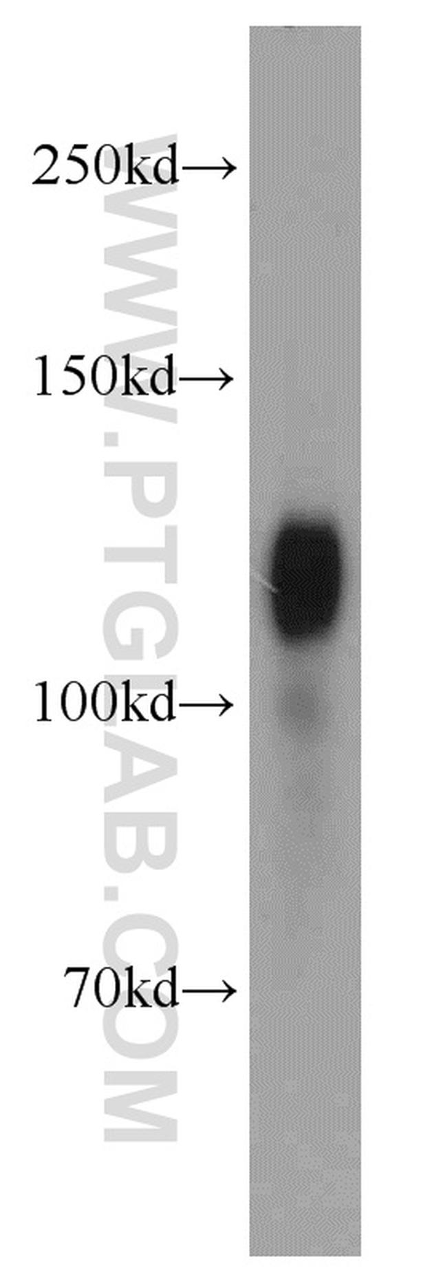 Amphiphysin Antibody in Western Blot (WB)