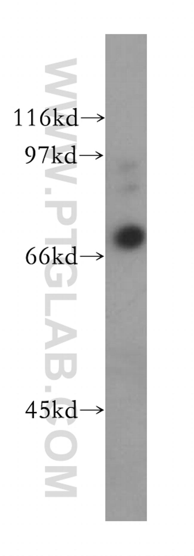 MUC20 Antibody in Western Blot (WB)