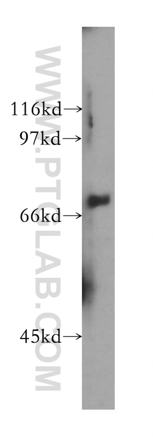 MUC20 Antibody in Western Blot (WB)