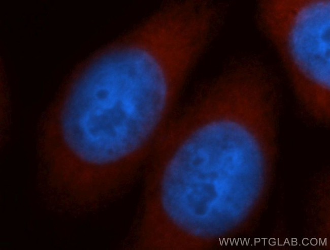 NCAPD2 Antibody in Immunocytochemistry (ICC/IF)