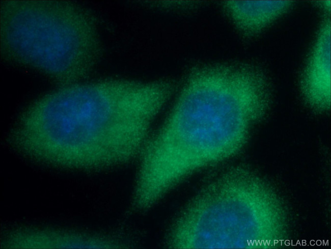 NCAPD2 Antibody in Immunocytochemistry (ICC/IF)