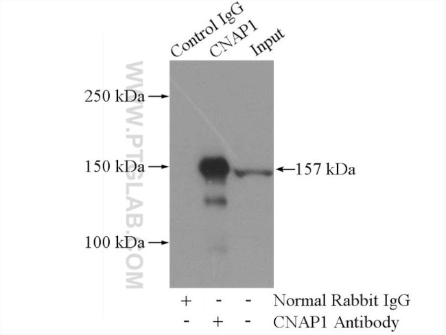 NCAPD2 Antibody in Immunoprecipitation (IP)