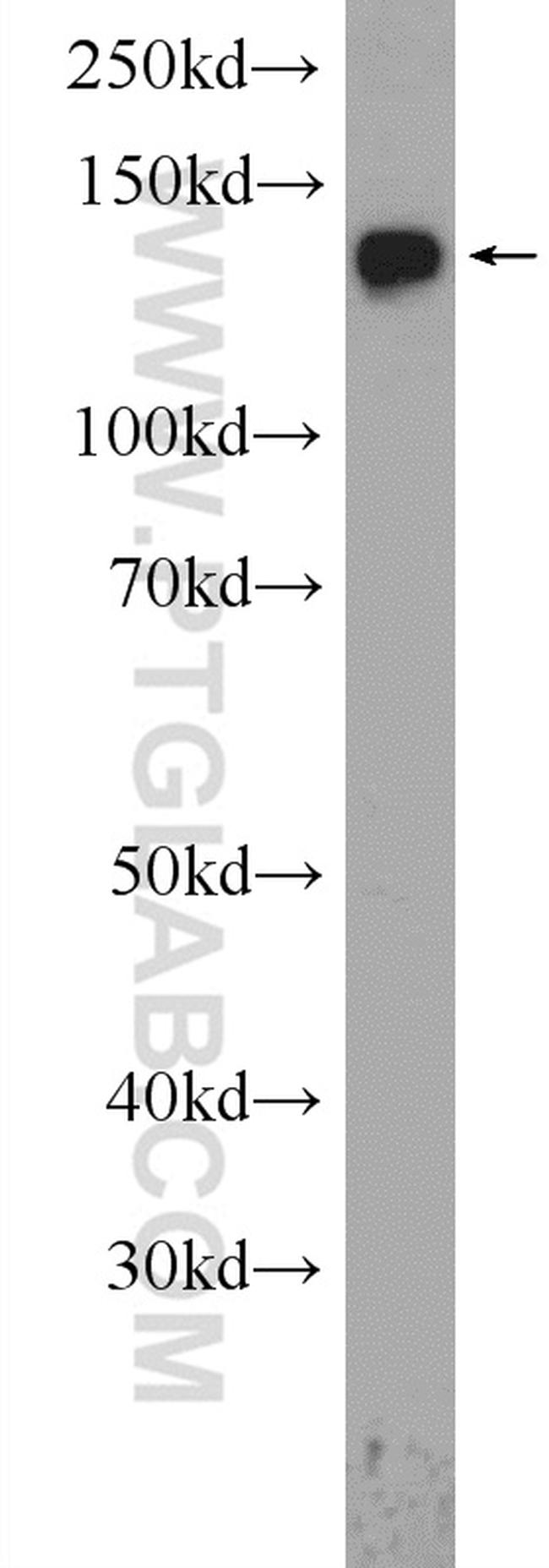 NCAPD2 Antibody in Western Blot (WB)