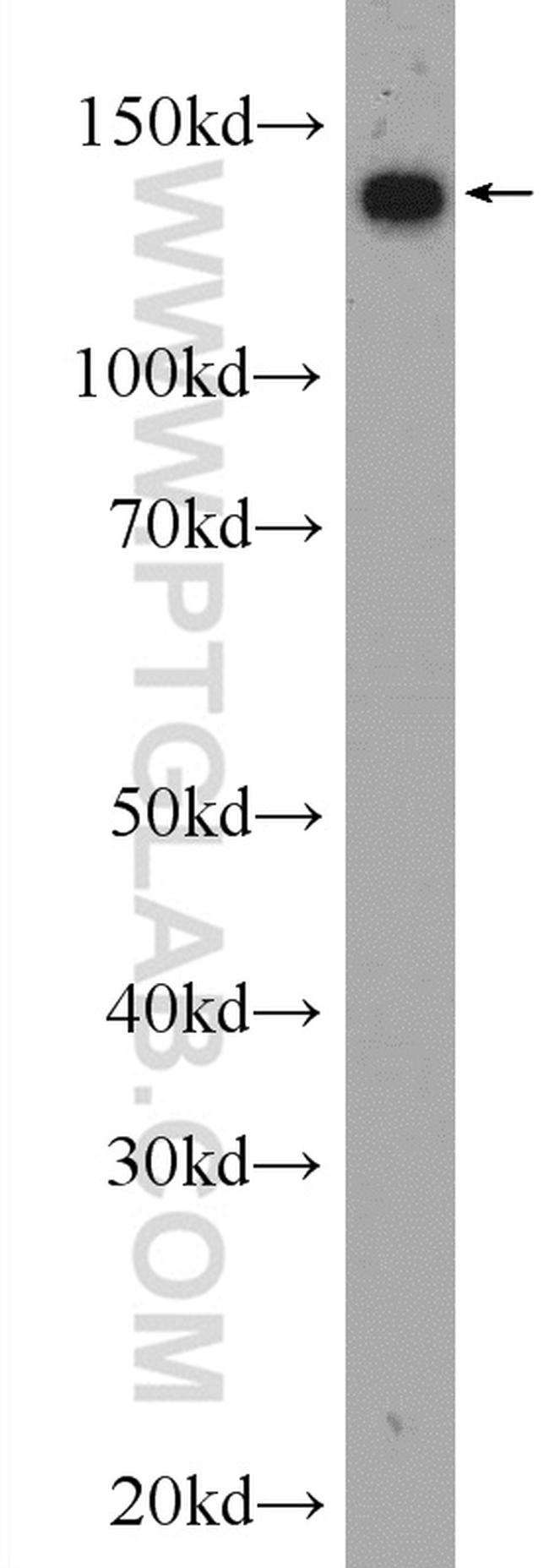 NCAPD2 Antibody in Western Blot (WB)