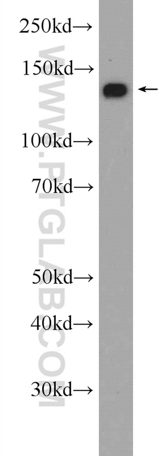 NCAPD2 Antibody in Western Blot (WB)