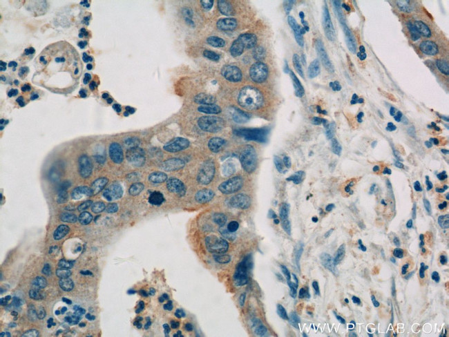 HSPH1 Antibody in Immunohistochemistry (Paraffin) (IHC (P))