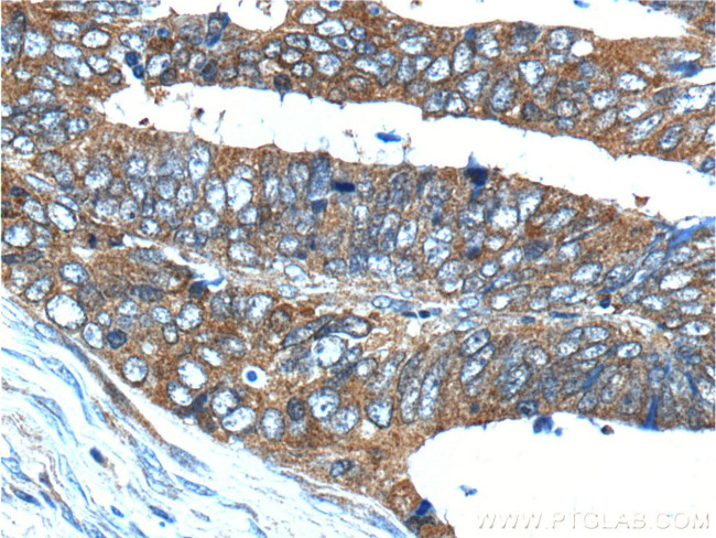 HSPH1 Antibody in Immunohistochemistry (Paraffin) (IHC (P))