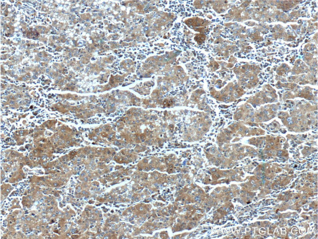 HSPH1 Antibody in Immunohistochemistry (Paraffin) (IHC (P))