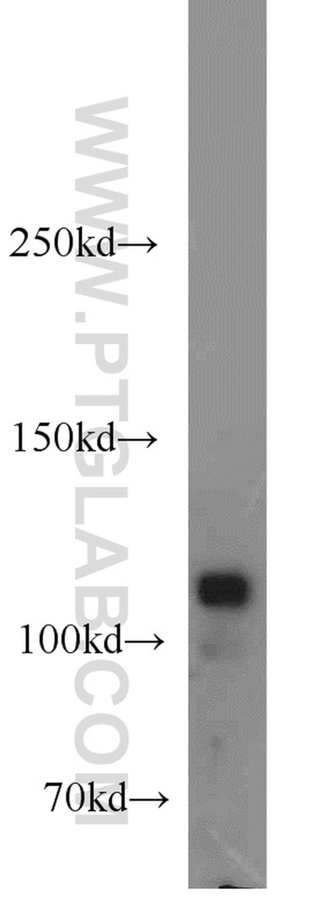 HSPH1 Antibody in Western Blot (WB)