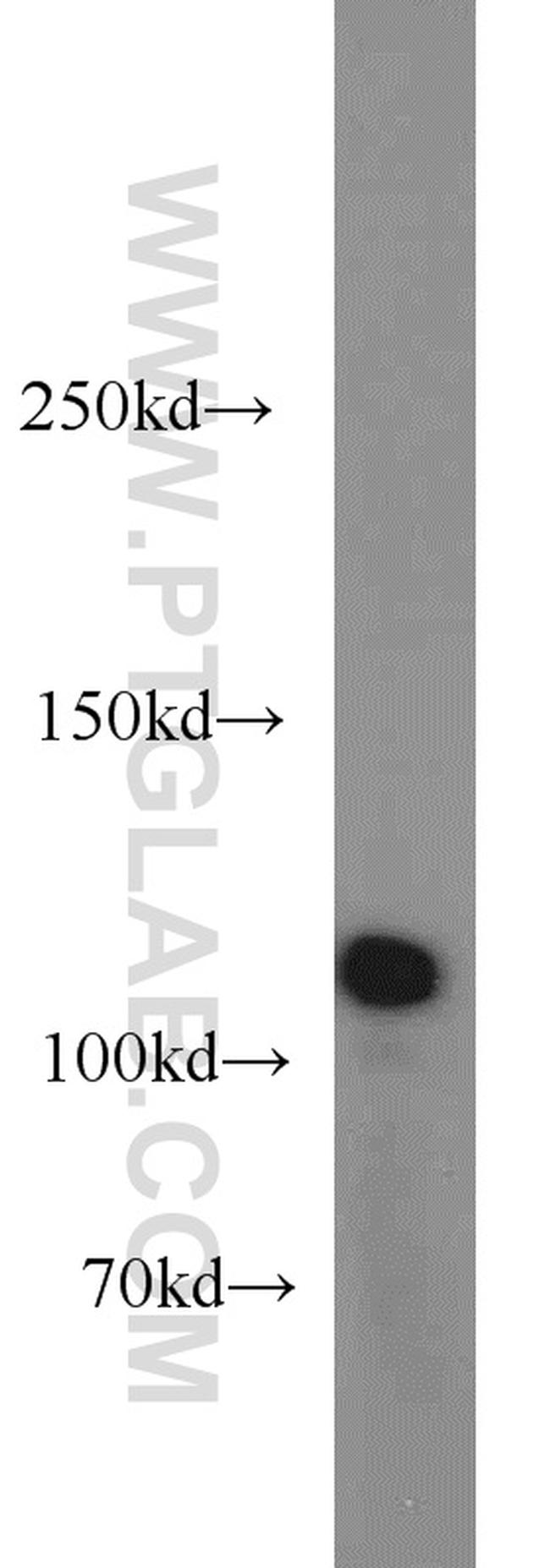 HSPH1 Antibody in Western Blot (WB)