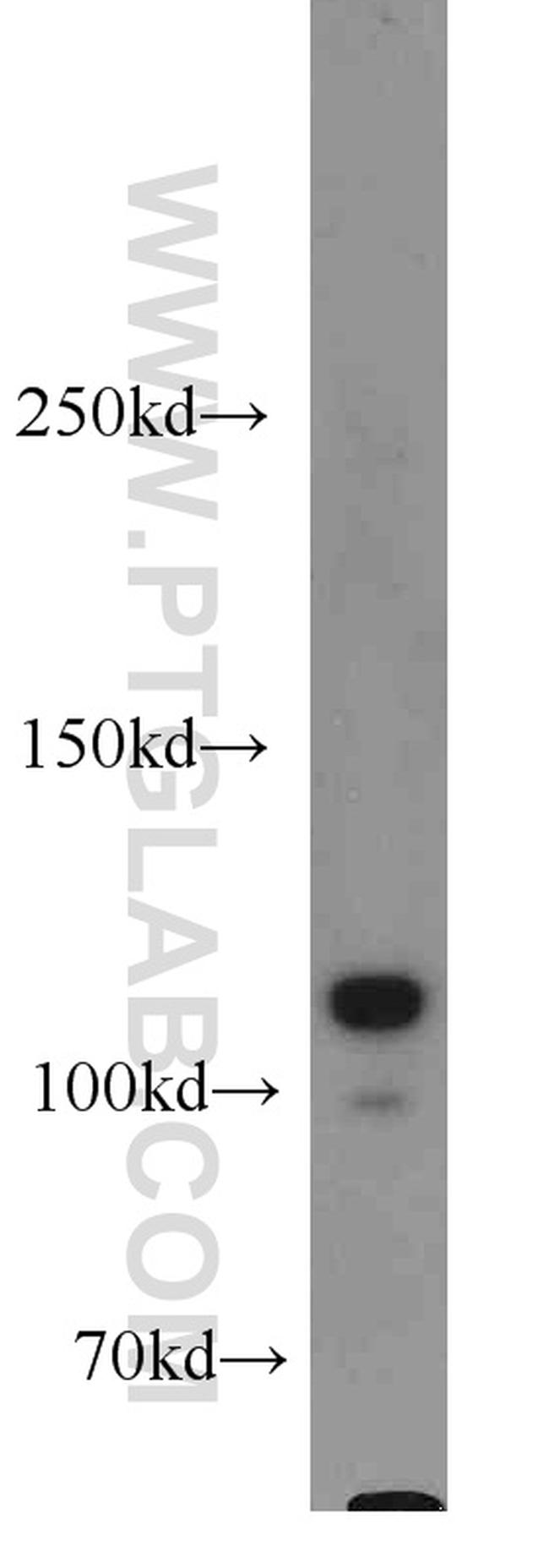 HSPH1 Antibody in Western Blot (WB)