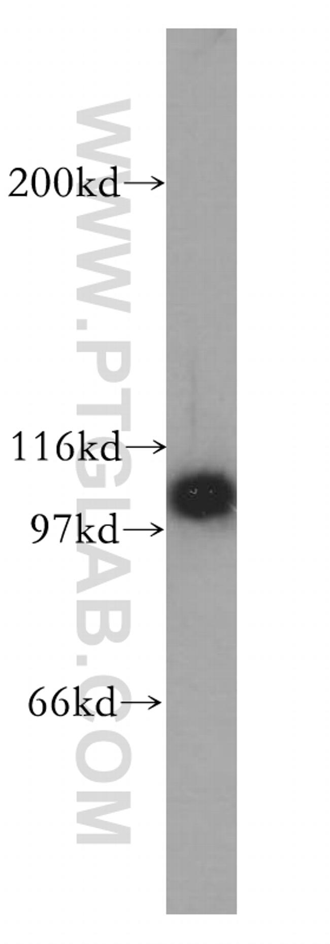 HSPH1 Antibody in Western Blot (WB)
