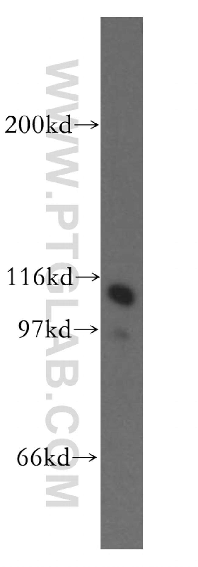 HSPH1 Antibody in Western Blot (WB)